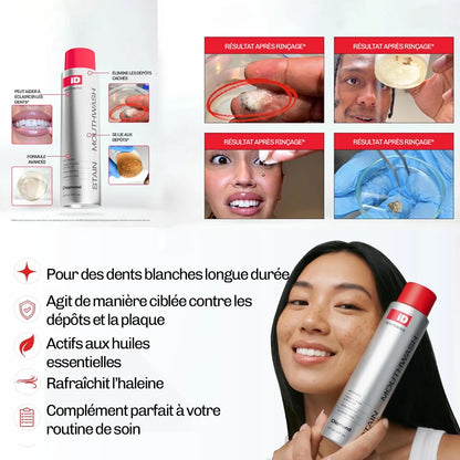 MouthCharm™ - Bain de bouche blancheur
